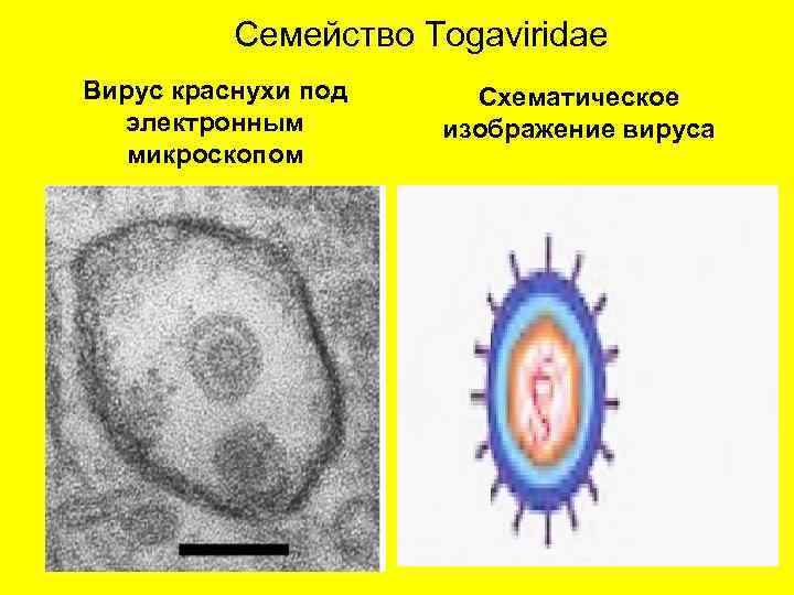 Семейство Togaviridae Вирус краснухи под электронным микроскопом Схематическое изображение вируса 