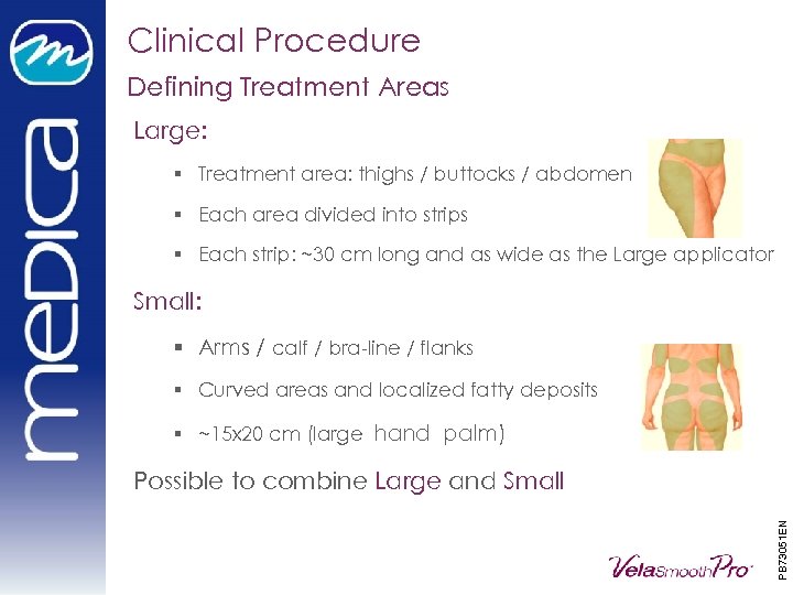 Clinical Procedure Defining Treatment Areas Large: § Treatment area: thighs / buttocks / abdomen