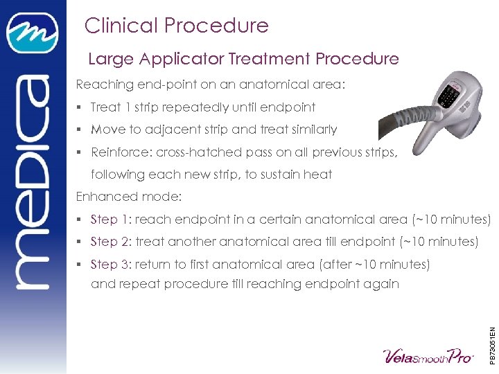 Clinical Procedure Large Applicator Treatment Procedure Reaching end-point on an anatomical area: § Treat