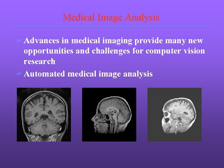 Medical Image Analysis ? Advances in medical imaging provide many new opportunities and challenges