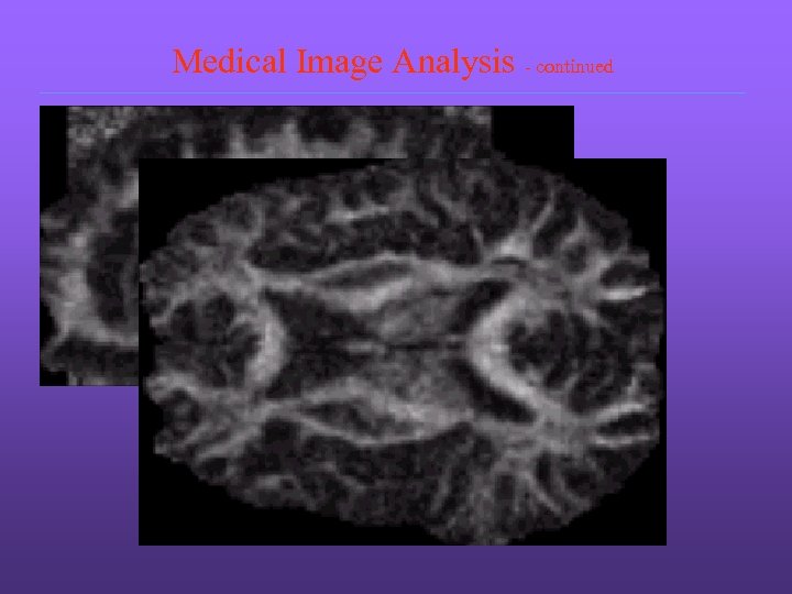 Medical Image Analysis - continued 
