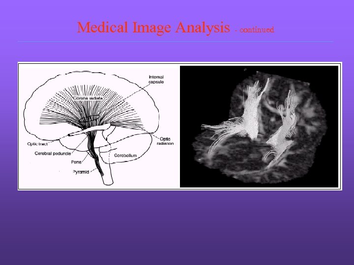 Medical Image Analysis - continued 