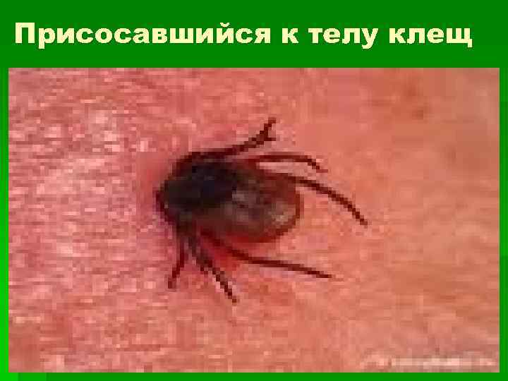 Присосавшийся к телу клещ 