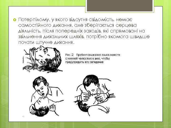  Потерпілому, у якого відсутня свідомість, немає самостійного дихання, але зберігається серцева діяльність, після