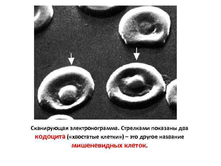 Сканирующая электронограмма. Стрелками показаны два кодоцита ( «хвостатые клетки» ) – это другое название