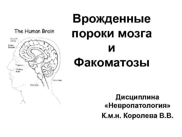 Brain 71. Невропатология. Дефекты мозга тоналкой не замажешь.