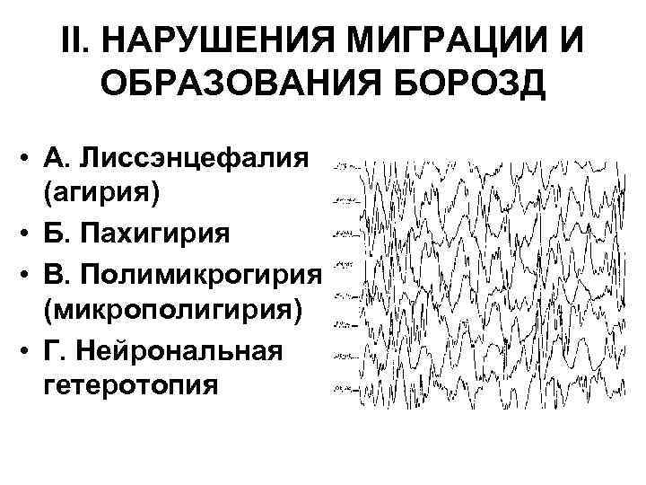 II. НАРУШЕНИЯ МИГРАЦИИ И ОБРАЗОВАНИЯ БОРОЗД • А. Лиссэнцефалия (агирия) • Б. Пахигирия •