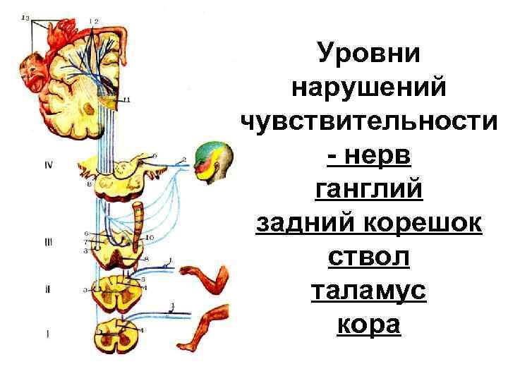 Уровни нарушений чувствительности - нерв ганглий задний корешок ствол таламус кора 