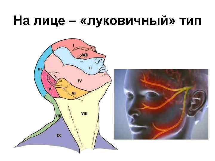 На лице – «луковичный» тип 