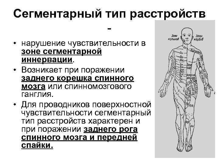 Сегментарный тип расстройства