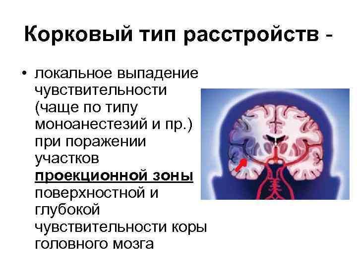 Корковый тип расстройств • локальное выпадение чувствительности (чаще по типу моноанестезий и пр. )