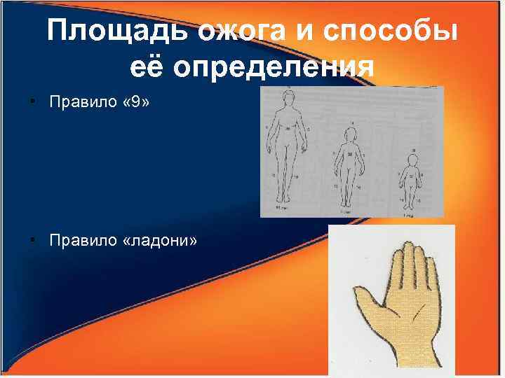 Площадь ожога и способы её определения • Правило « 9» • Правило «ладони» 