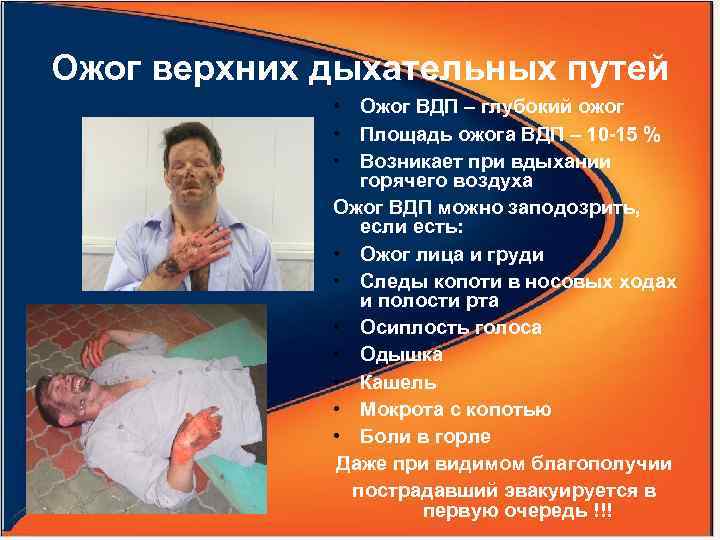 Ожог верхних дыхательных путей • Ожог ВДП – глубокий ожог • Площадь ожога ВДП