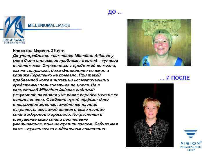 ДО … Насонова Марина, 35 лет. До употребления косметики Millenium Alliance у меня были