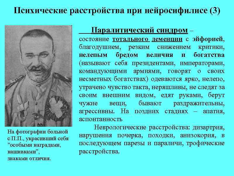 Психические расстройства при нейросифилисе (3) Паралитический синдром – На фотографии больной с П. П.