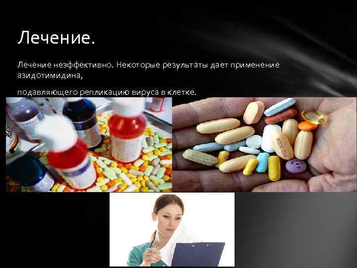 Лечение неэффективно. Некоторые результаты дает применение азидотимидина, подавляющего репликацию вируса в клетке. 