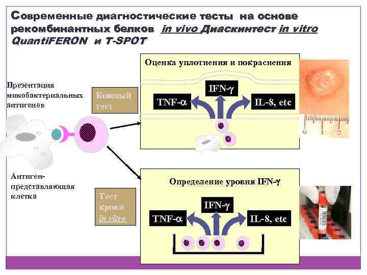 Современные диагностические тесты на основе рекомбинантных белков in vivo Диаскинтест in vitro Quanti. FERON