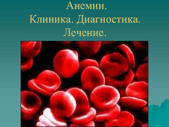 Анемии. Клиника. Диагностика. Лечение. 