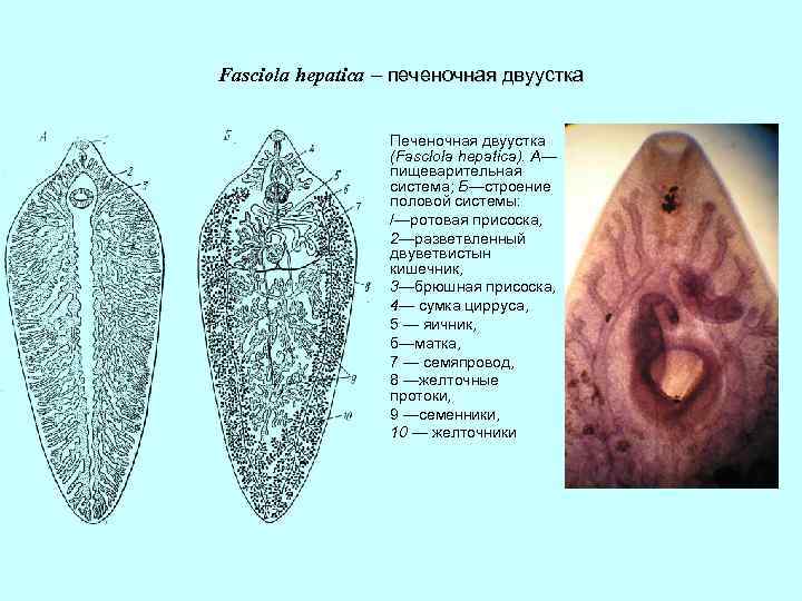 Печеночная д. Двуустка печеночная (Fasciola hepatica). Печеночный сосальщик (Fasciola hepatica). Марита фасциолы. Половая система печеночного сосальщика.