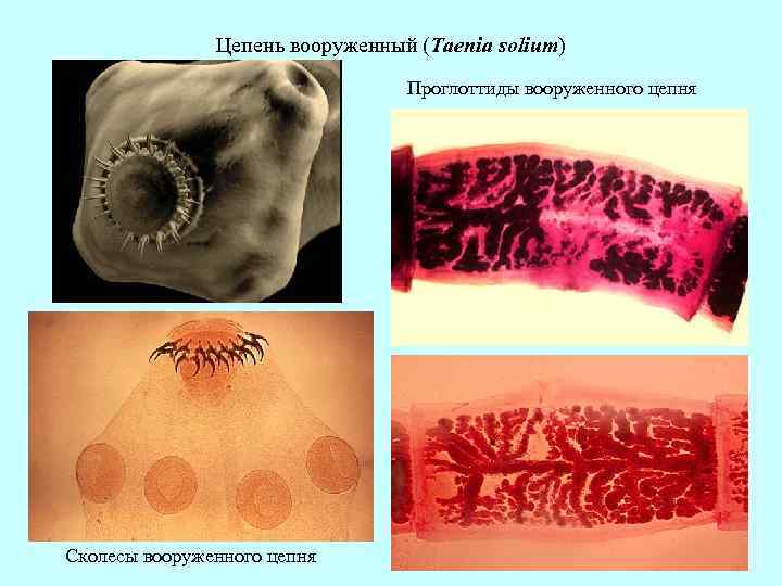 Цепень вооруженный (Taenia solium) Проглоттиды вооруженного цепня Сколесы вооруженного цепня 