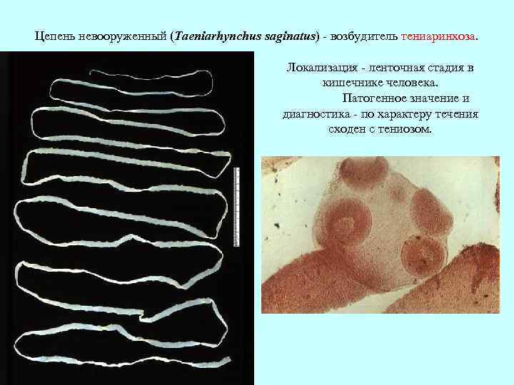 Цепень невооруженный (Taeniarhynchus saginatus) - возбудитель тениаринхоза. Локализация - ленточная стадия в кишечнике человека.