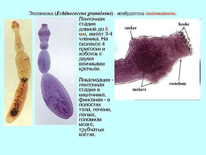  Эхинококк (Echinococcus granulosus) - возбудитель эхинококкоза. Ленточная стадия длиной до 6 мм, имеет