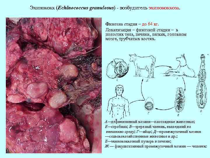 Эхинококк (Echinococcus granulosus) - возбудитель эхинококкоза. Финозна стадия – до 64 кг. Локализация –