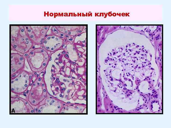 Нормальный клубочек 