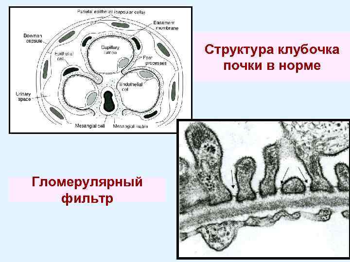 Структура клубочка почки в норме Гломерулярный фильтр 