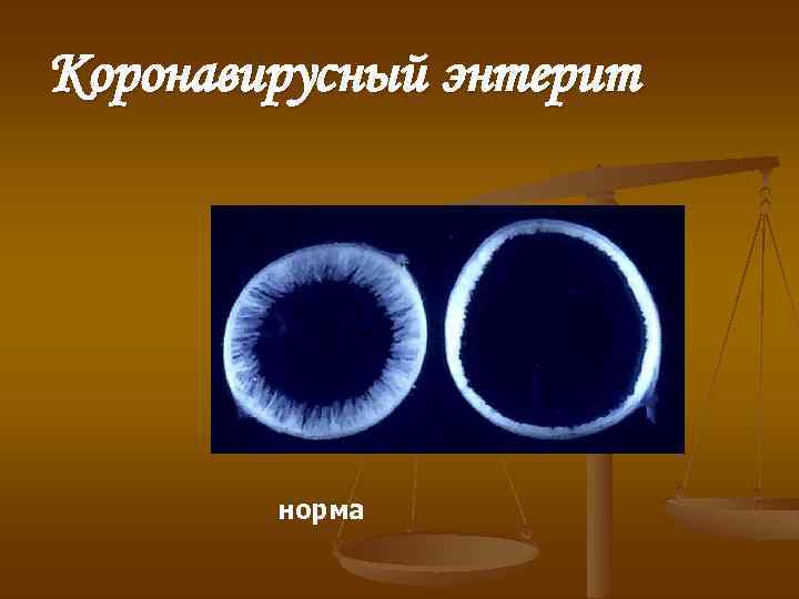 Коронавирусный энтерит норма 