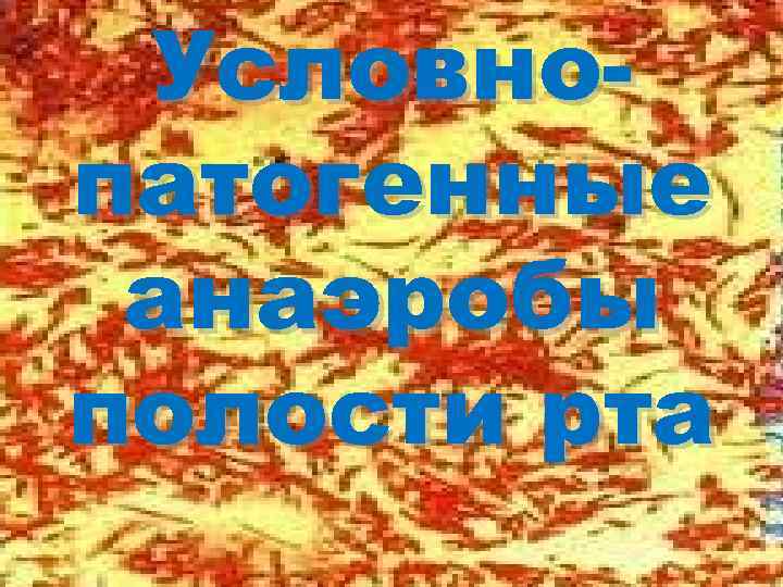 Условнопатогенные анаэробы полости рта 