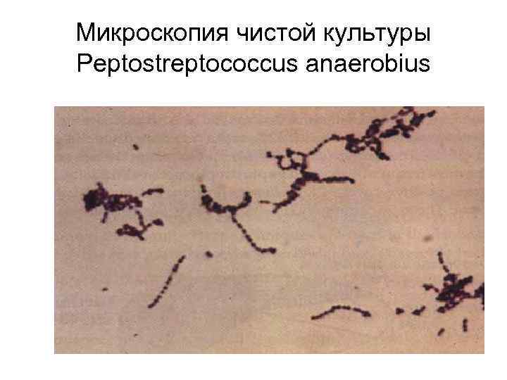 Микроскопия чистой культуры Peptostreptococcus anaerobius 