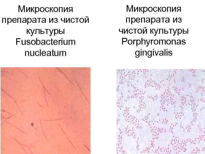 Микроскопия препарата из чистой культуры Fusobacterium nucleatum Микроскопия препарата из чистой культуры Porphyromonas gingivalis