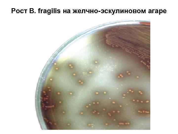 Рост B. fragilis на желчно-эскулиновом агаре 