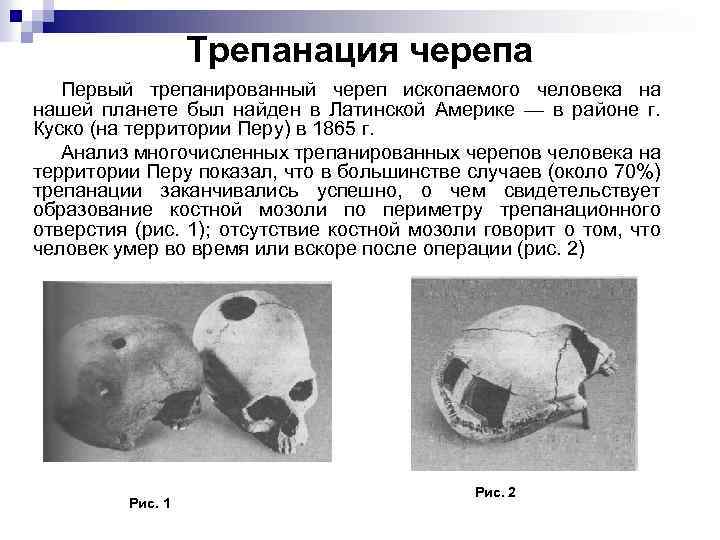 Трепанация черепа Первый трепанированный череп ископаемого человека на нашей планете был найден в Латинской
