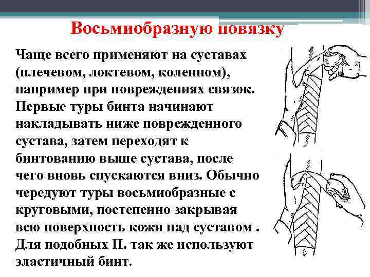 Восьмиобразную повязку Чаще всего применяют на суставах (плечевом, локтевом, коленном), например при повреждениях связок.