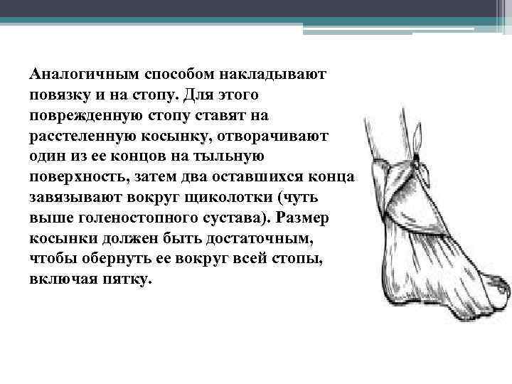 Аналогичным способом накладывают повязку и на стопу. Для этого поврежденную стопу ставят на расстеленную