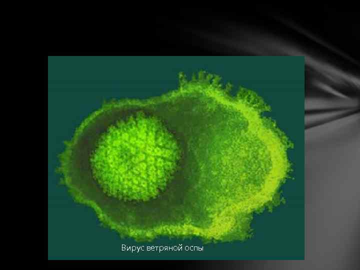 Вирус ветряной оспы 