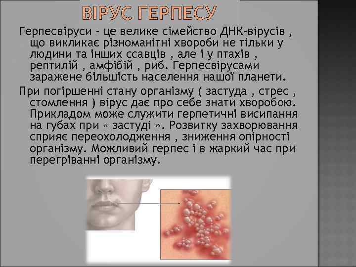 ВІРУС ГЕРПЕСУ Герпесвіруси - це велике сімейство ДНК-вірусів , що викликає різноманітні хвороби не