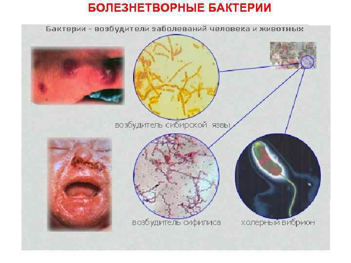 БОЛЕЗНЕТВОРНЫЕ БАКТЕРИИ 