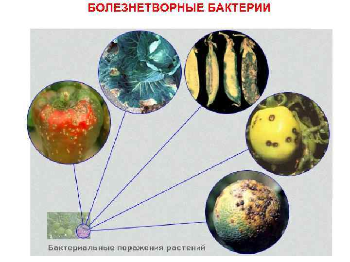 БОЛЕЗНЕТВОРНЫЕ БАКТЕРИИ 