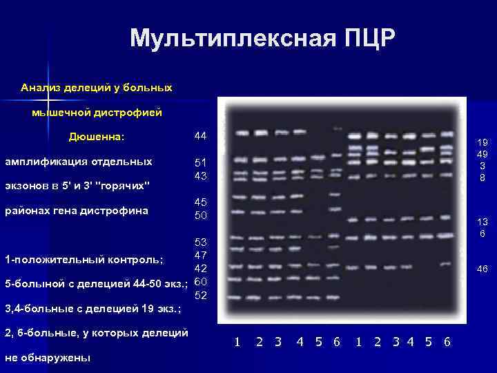 Прямые методы днк диагностики