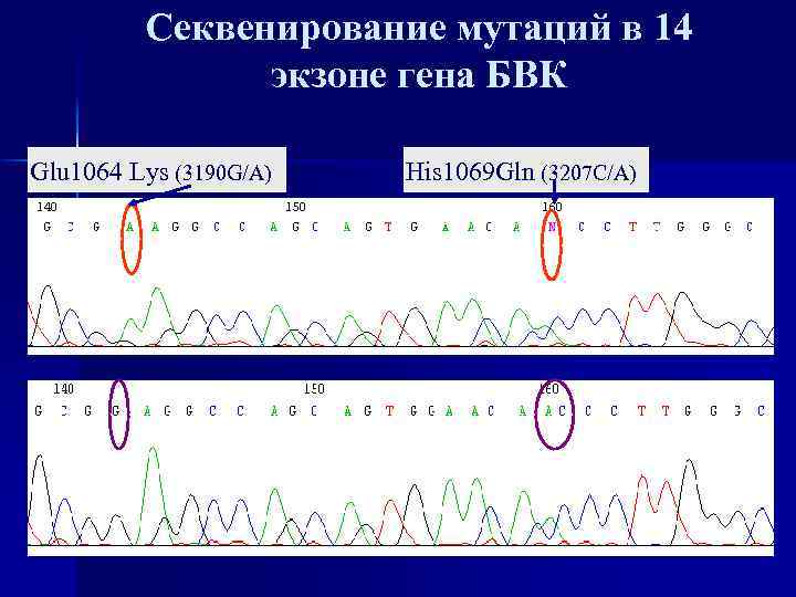 Секвенирование мутаций в 14 экзоне гена БВК Glu 1064 Lys (3190 G/A) His 1069