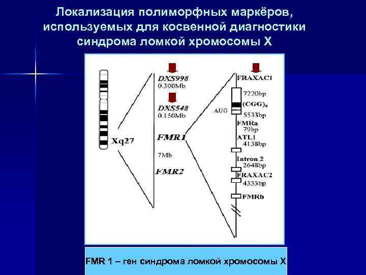 Локализация полиморфных маркёров, используемых для косвенной диагностики синдрома ломкой хромосомы Х FMR 1 –