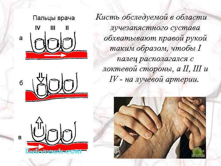 Кисть обследуемой в области лучезапястного сустава обхватывают правой рукой таким образом, чтобы I палец