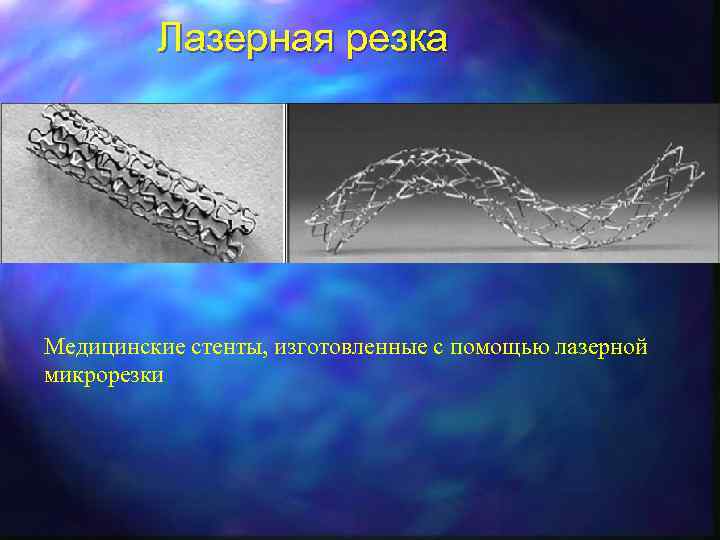 Лазерная резка Медицинские стенты, изготовленные с помощью лазерной микрорезки 