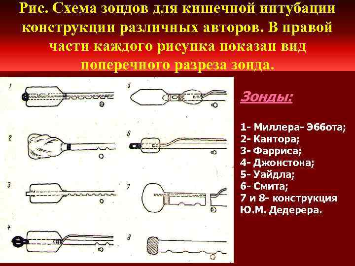 Рис. Схема зондов для кишечной интубации конструкции различных авторов. В правой части каждого рисунка