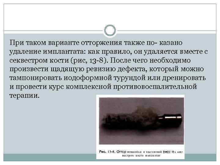 При таком варианте отторжения также по казано удаление имплантата: как правило, он удаляется вместе