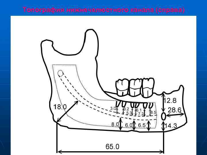 Топография нижнечелюстного канала (справа) 