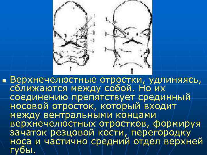 n Верхнечелюстные отростки, удлиняясь, сближаются между собой. Но их соединению препятствует срединный носовой отросток,